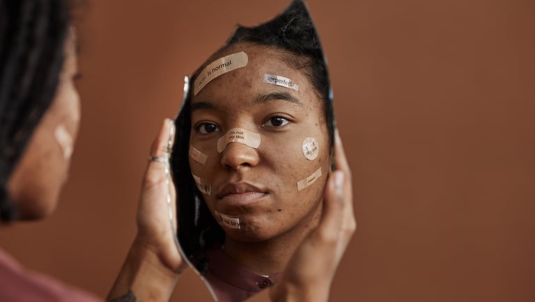 A woman looks at her reflection in a broken mirror while wearing acne positivity bandages on her face.