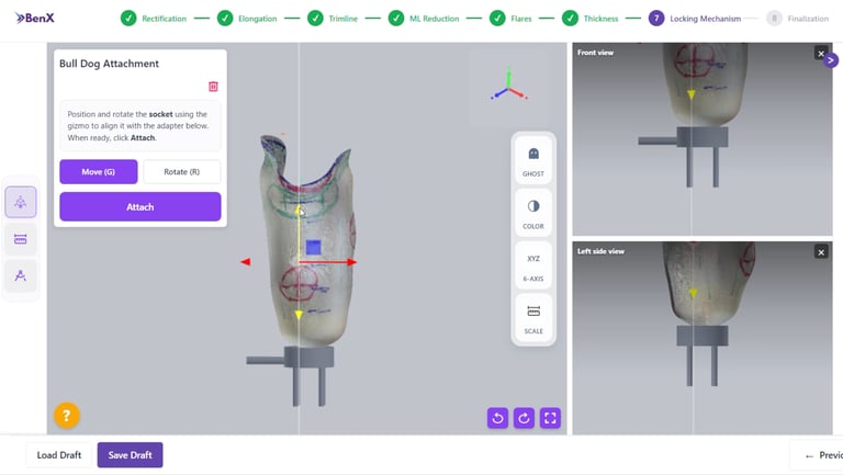BenX custom prosthetic socket design platform