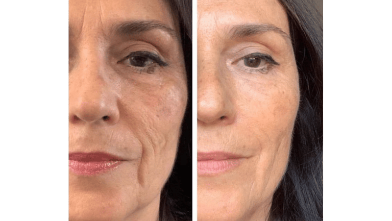 Elixir da Beleza 02- Skinbooster