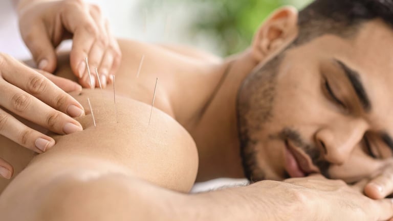 Acupuncture in Temecula California