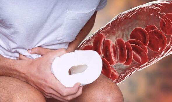 GASTRO FOUNDATION Bloody diarrhoea