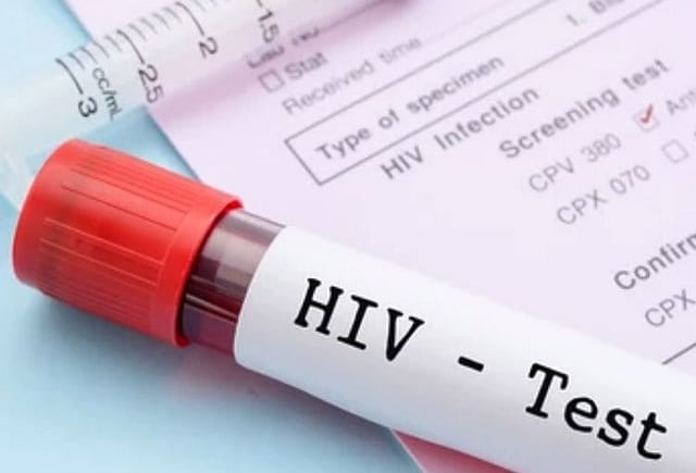 Pakistan Sees Record Surge in HIV Cases — Health Experts Warn of Looming Crisis