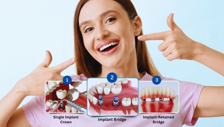 dental implant specialist in baner