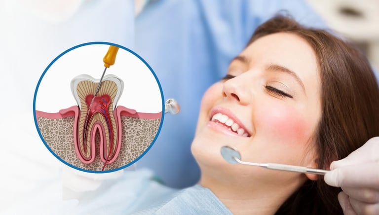 root canal treatment in baner