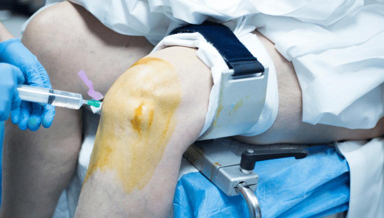 Post-Surgery At Home Recovery