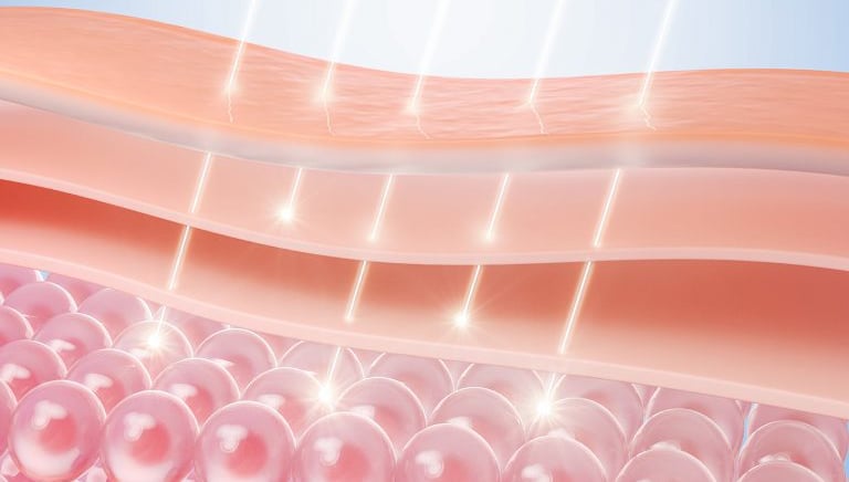 Kaltlichtlaser Divinia Eclibs Slim Mun-ik München