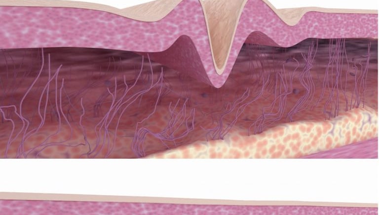 Trägerfrequenzwelle Divinia Eclibs Slim mun-ik München