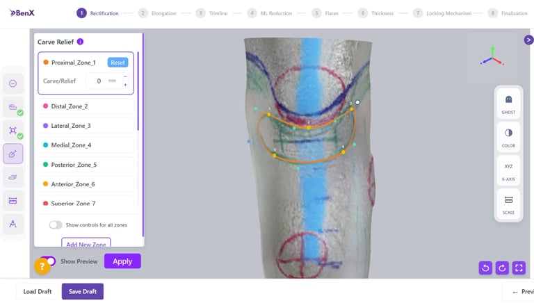 BenX digital orthotics and prosthetics system