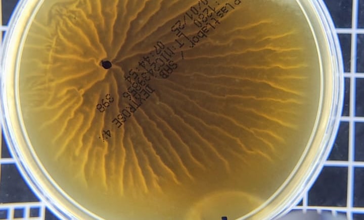 Recipiente de análise laboratorial contendo amostra de água com resultado positivo para Legionella,