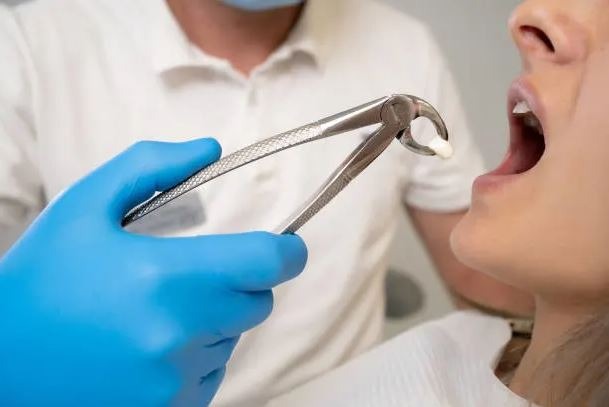 Tooth extraction Greenville SC