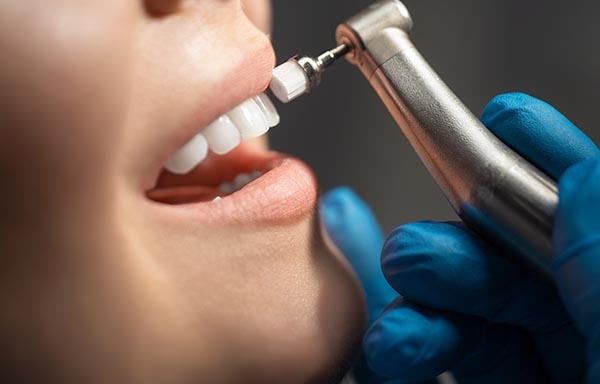 Cosmetic dentistry teeth cleaning greenville sc