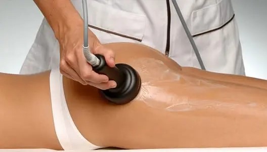 Aplicación de mesoterapia virtual corporal mediante dispositivo para nutrir la piel.