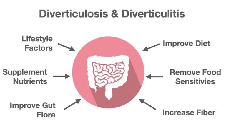 دليل 2026 لفهم العلاقة بين الرتج (Diverticulosis) والصيام: تعرّف على الأخطاء الشائعة التي تزيد الضغط