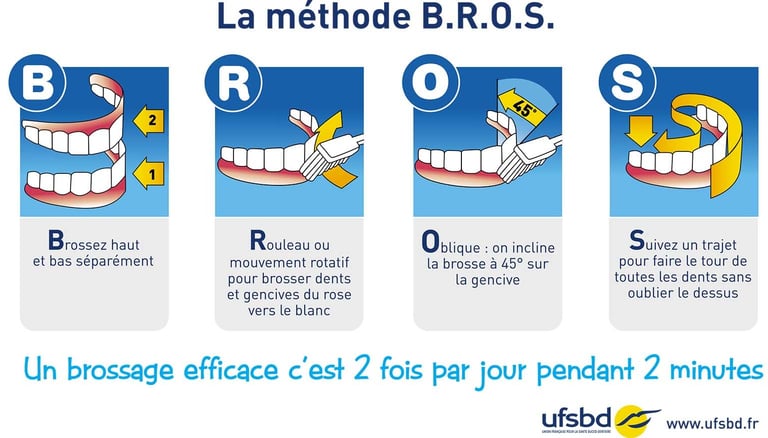 Adoptez la méthode B.R.O.S. pour votre brossage dentaire