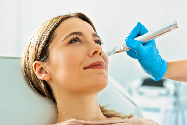 Microneedling in Temecula California