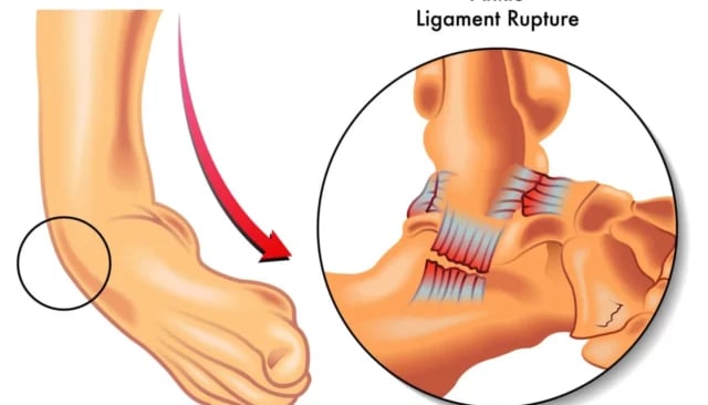 Dr.Rajinikanth's ortho clinic ligament injury
