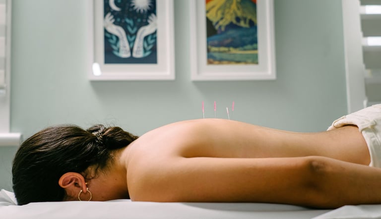 Patient receiving professional acupuncture therapy with needles in back for holistic pain relief.