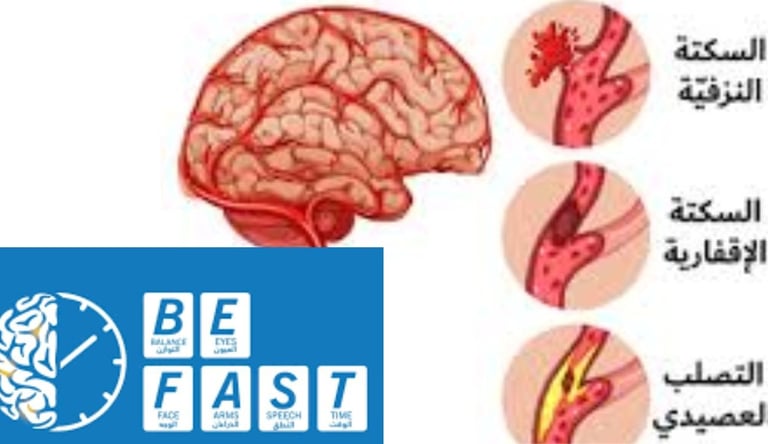 علامات السكته