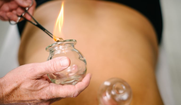 A practitioner performs fire cupping therapy using a glass cup and flame on a patient's back for muscle recovery.