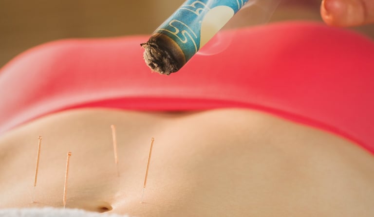 combinação terapeutica de moxabustao e agulhas de acupuntura