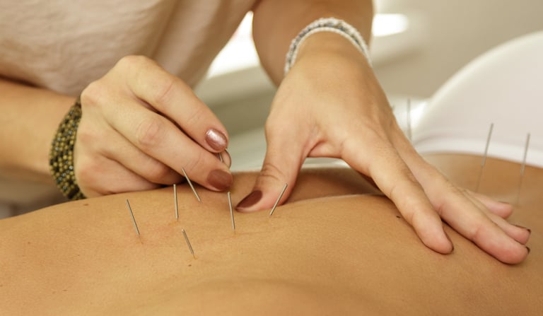 agulhas de acupuntura nas costas