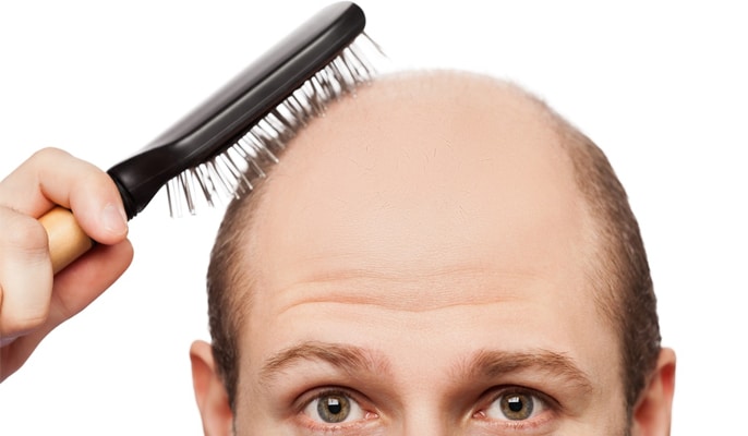 Homem calvo penteando o que seria os cabelos.