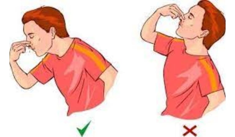 الطريقه الصحيحة وقف النزيف