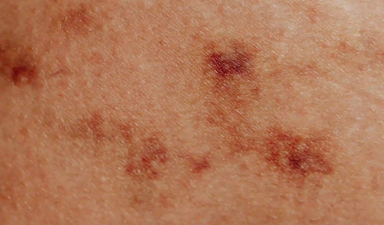 a close up of a person's leg with a tattoo on it