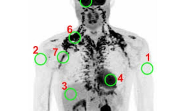 ❄️Accurate Evaluating Brown Adipose Tissue