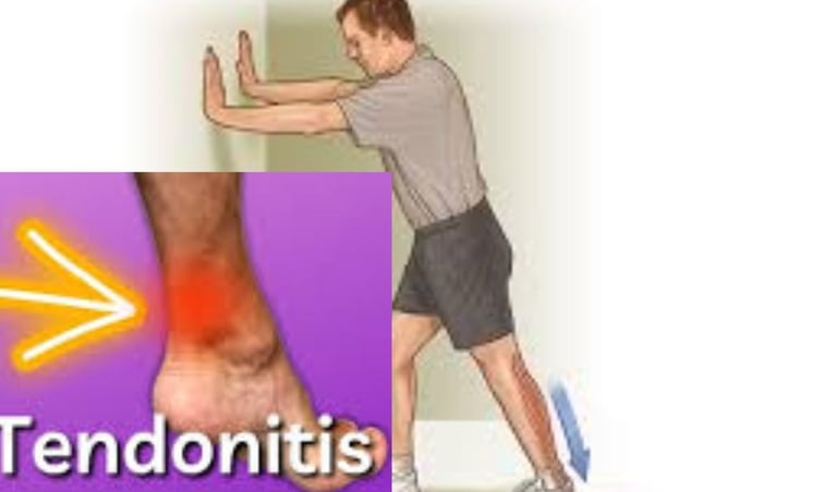 achilles tendon