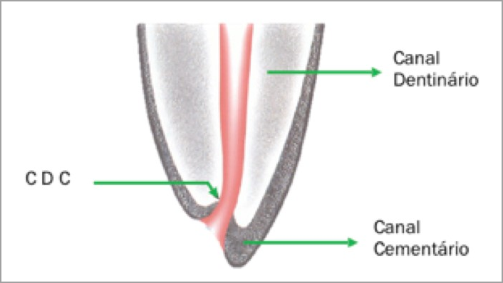 limite cdc preparo biomecânico endodontia resumo concurso odontologia
