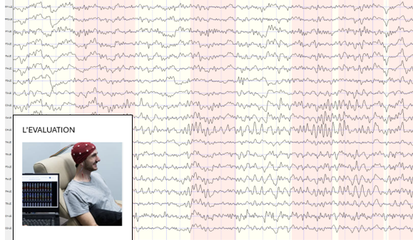 extrait de tracé EEG