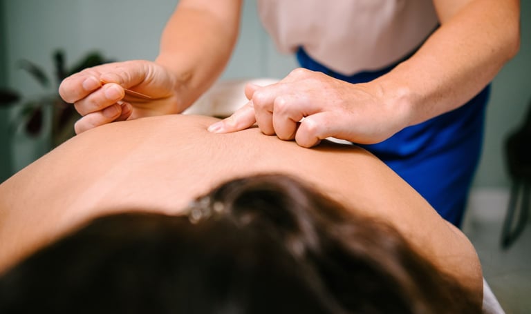 Professional acupuncturist inserting a sterile needle into a patient's back for dry needling therapy.