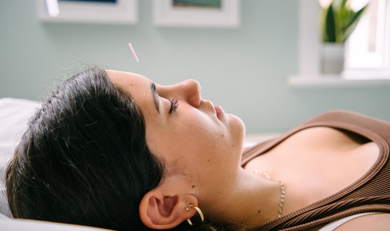 A woman receiving a facial acupuncture treatment with a needle inserted in her forehead for holistic wellness.