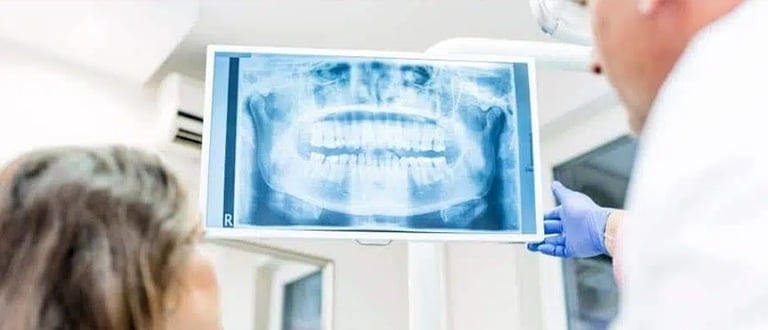 X-Ray of whole mouth front view