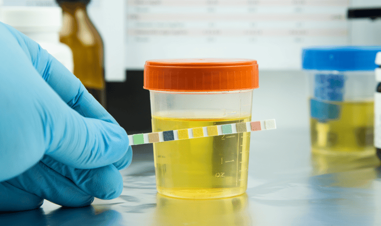 urine drug test | drug screening | 5 panel | 10 panel 