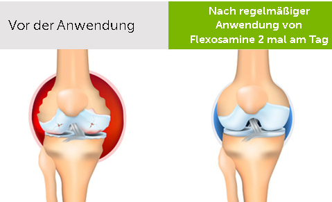 Vorteile von Flexosamine