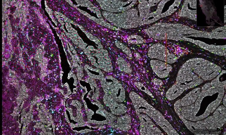 A multiplex immunoflourescence image from the paper that this image links to
