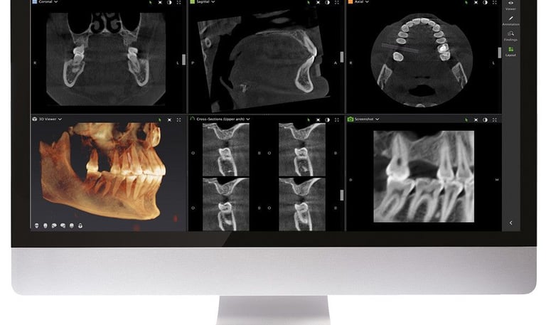 Tac Cone Bean progettazione di un caso clinico