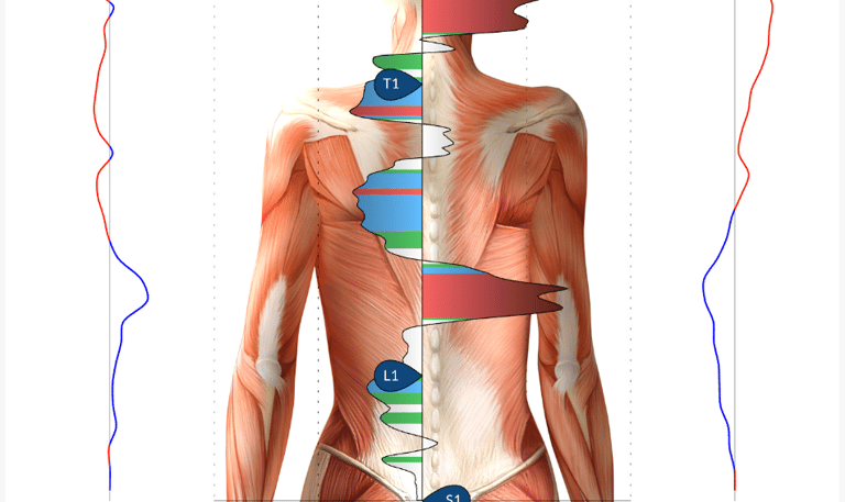 nervous system scan for speech delay in Franklin, TN office