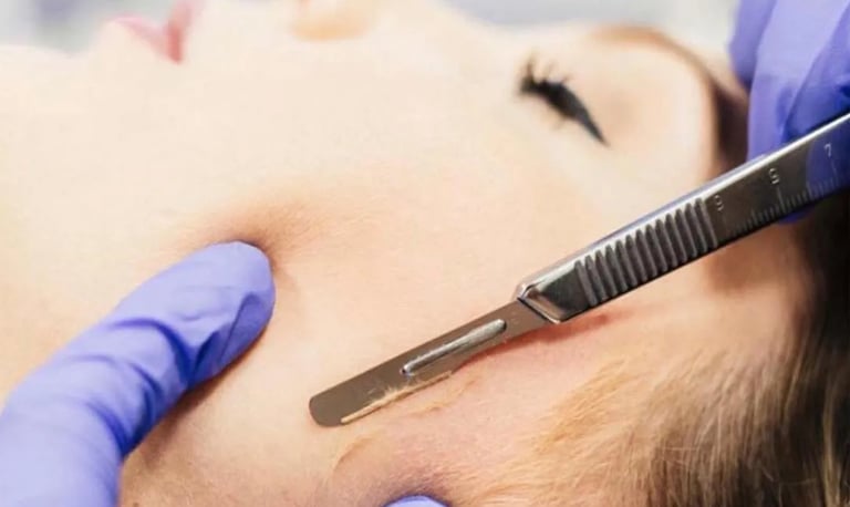 dermaplaning smooth skin