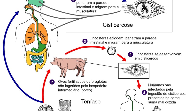 Teníase e Cisticercose