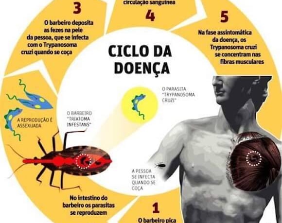 Doença de Chagas