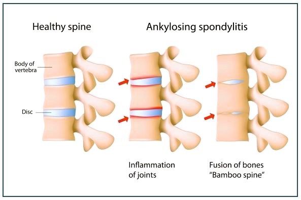 a diagram of a healthy spiner spiner