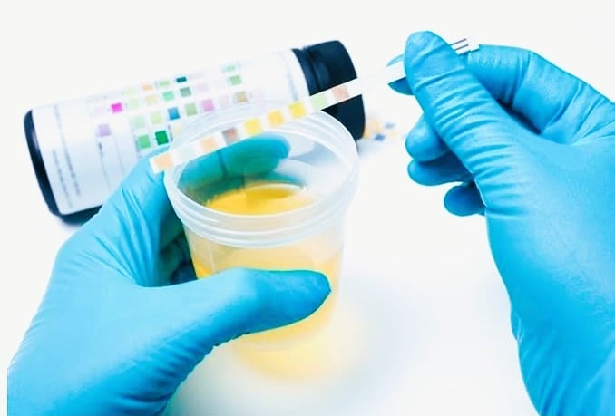 Urine