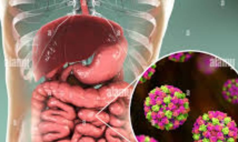 S Norwalk virus (norovirus), enteric adenoviruses, astrovirus, cytomegalovirus, and hepatitis viruse