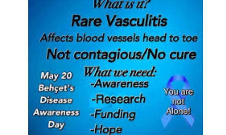 vasculitis