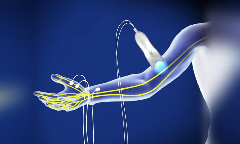 Dr.Rajinikanth's ortho clinic Nerve conduction study