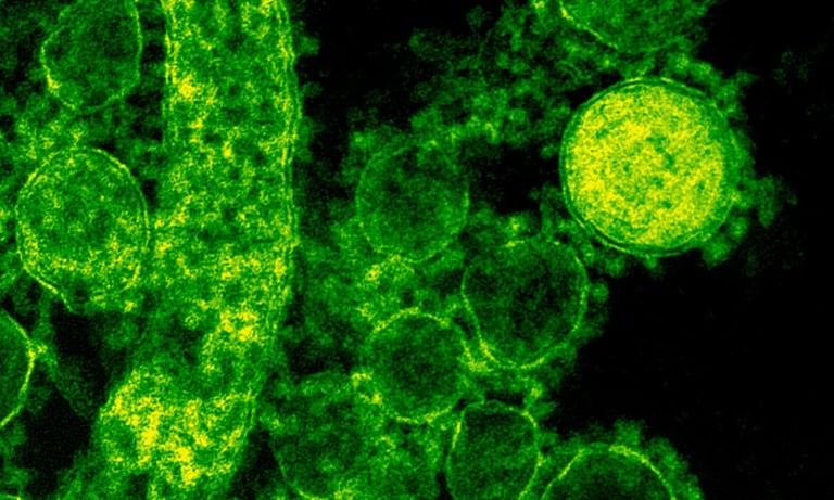 Close up of a virus through a microscope