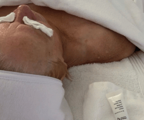 Femme recevant un soin naturels du visage